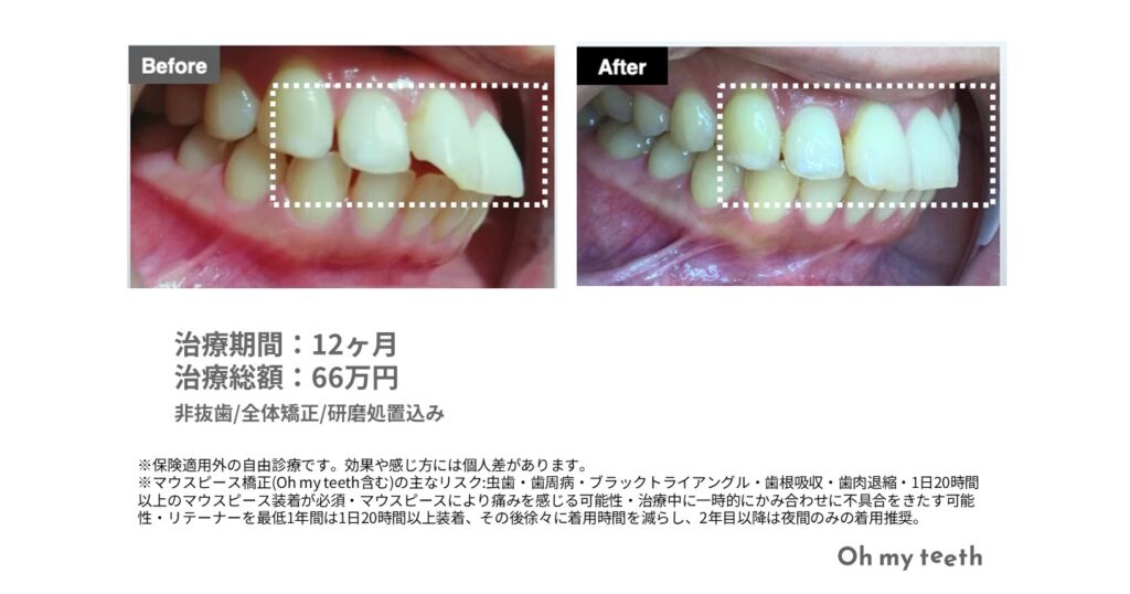 症例画像データ