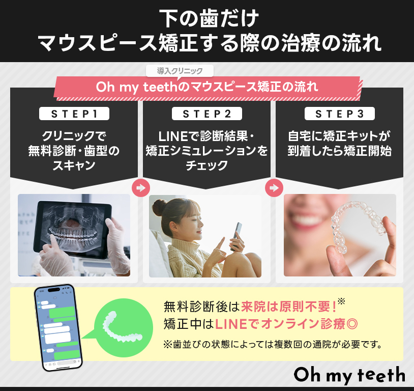 下の歯だけマウスピース矯正する際の治療の流れ