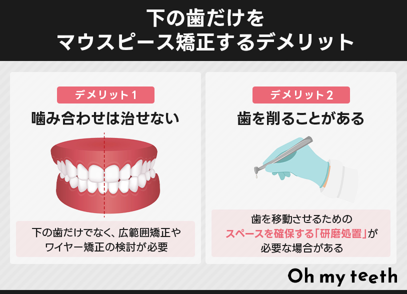 下の歯だけをマウスピース矯正するデメリット